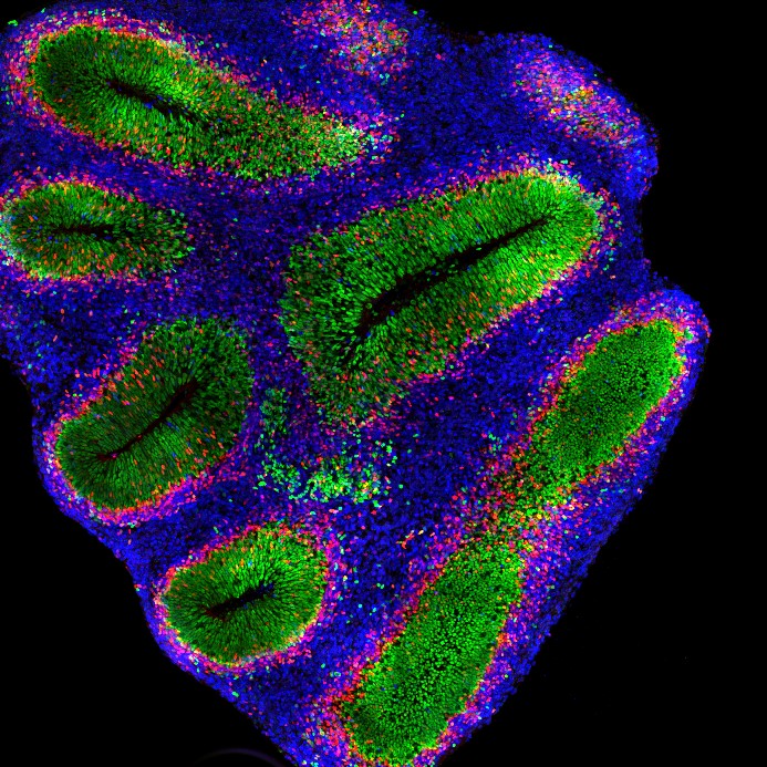 Organoïde cortical au stade 8 semaines. © Alexandre Baffet, Institut Curie