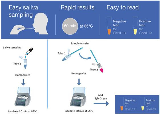 Promising Initial Results For A COVID-19 Diagnostic Test In Saliva | CNRS