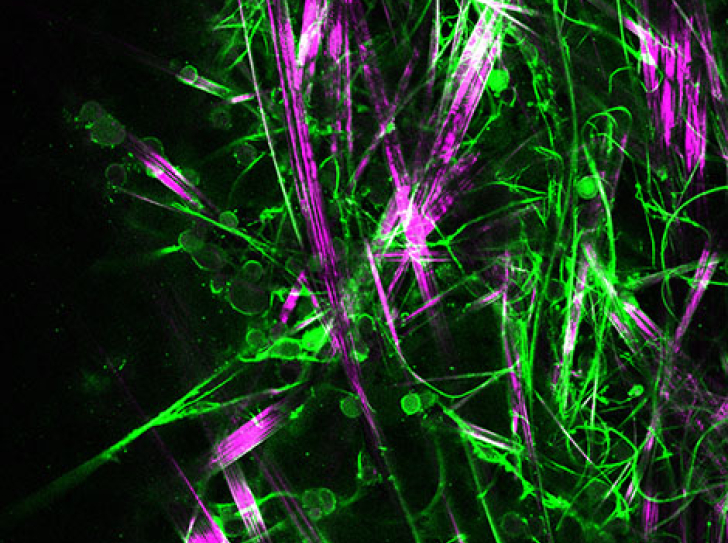 Une nouvelle molécule gélifiante pour la culture de neurones en 3D