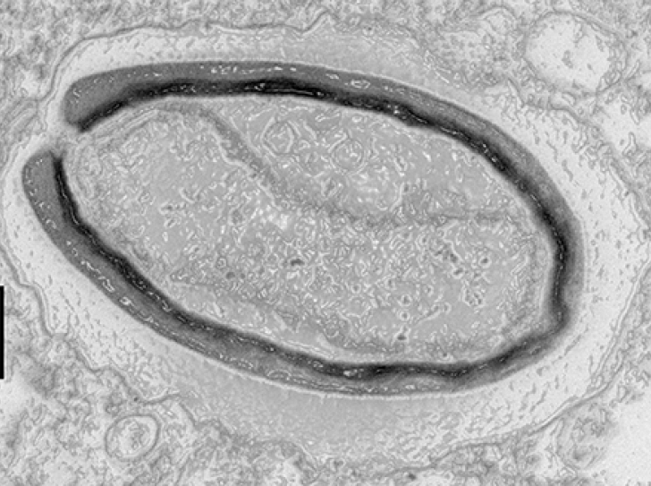 Pandoravirus : giant viruses invent their own genes