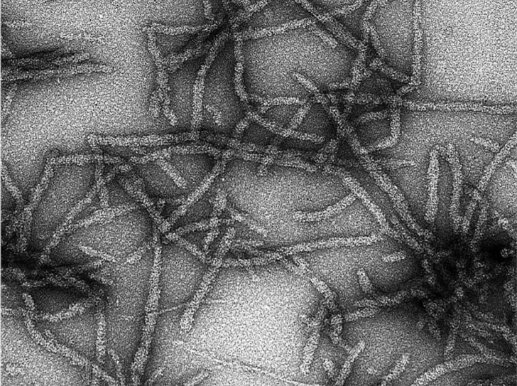 Fibres que forme le prion lorsqu'il devient transmissible. Cette image a été obtenue par microscopie. 