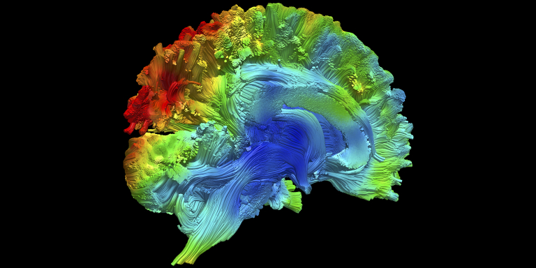 Tractographie de l'IRM de diffusion du cerveau humain vivant