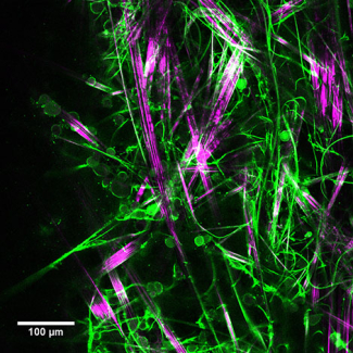 Une nouvelle molécule gélifiante pour la culture de neurones en 3D