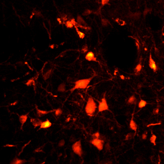 Sommeil paradoxal : ces neurones qui nous paralysent