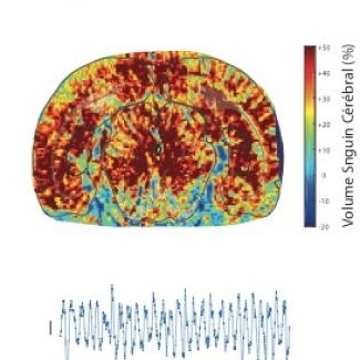 Cerveau sommeil paradoxal