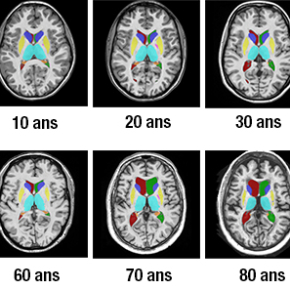 Comment Notre Cerveau Change-t-il Au Cours De Notre Vie ? | CNRS